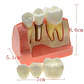 Modelo Dental Enseñanza Y Estudio Puente Gigante Santiago - Miniatura 2