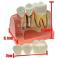 Modelo Dental Enseñanza Y Estudio Puente Gigante Santiago - Miniatura 4