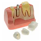 Modelo Dental Enseñanza Y Estudio Puente Gigante Santiago - Miniatura 5