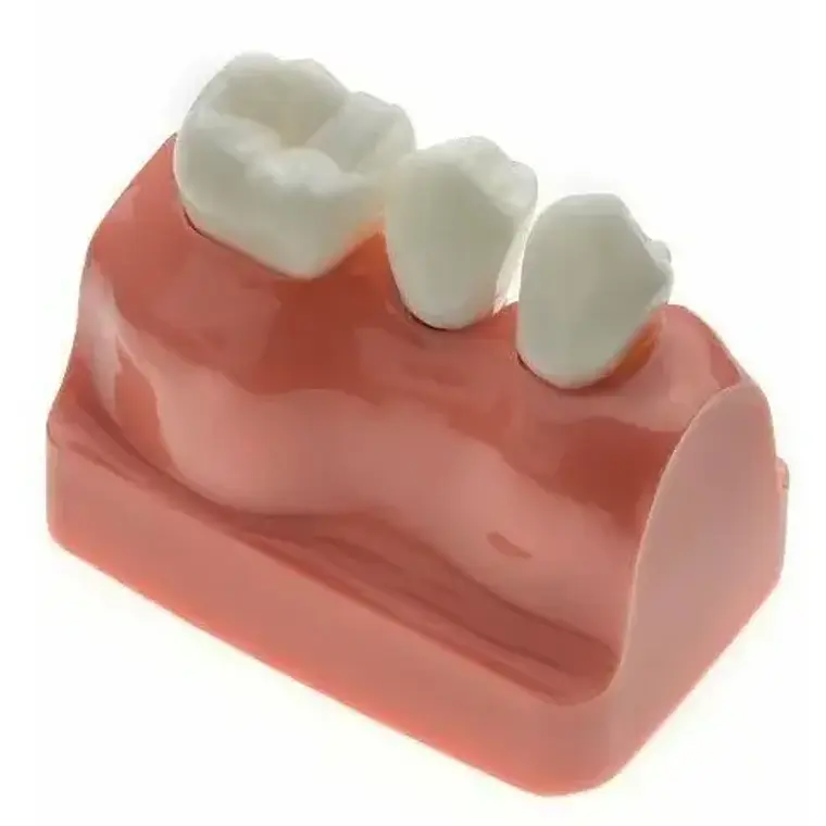 Modelo Dental Enseñanza Y Estudio Puente Gigante Santiago 6