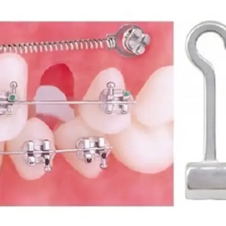Crimpables Hook Ortodoncia Bolsita 10u Santiago 6