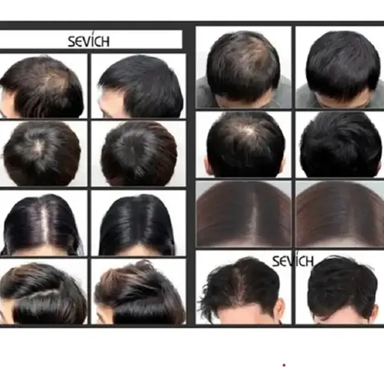 Toppik Recarga Pelo Polvo 100g No Nano Hair Fibras Santiago 21