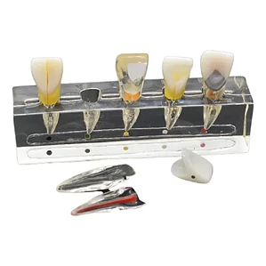 Modelo Endodoncia Dental Acrílico Enseñanza Didáctico Stgo.