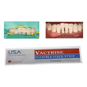 Banda De Refuerzo Dental Tira De Fibra Tipo Ribbond Calidad