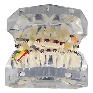 Modelo Dental Ortodoncia Brackets Acrilico Con Adm Santiago