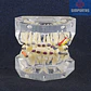 Modelo Dental Ortodoncia Brackets Acrilico Con Adm Santiago - Miniatura 3