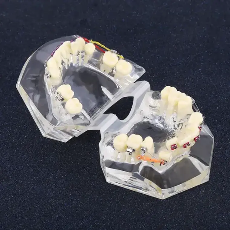 Modelo Dental Ortodoncia Brackets Acrilico Con Adm Santiago 7