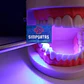 Lampara Dental Fotocurado Ultrarapida 1 Seg Ultradelgada Sgo - Miniatura 6