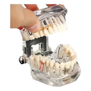 Modelo Dental Enseñanza Y Tratamientos Implantes Protesis