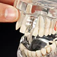Modelo Dental Enseñanza Y Tratamientos Implantes Protesis - Miniatura 4