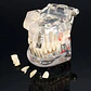 Modelo Dental Enseñanza Y Tratamientos Implantes Protesis - Miniatura 6