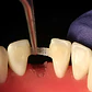 Banda De Refuerzo Dental Tira De Fibra Tipo Ribbon 1 Rollo - Miniatura 3