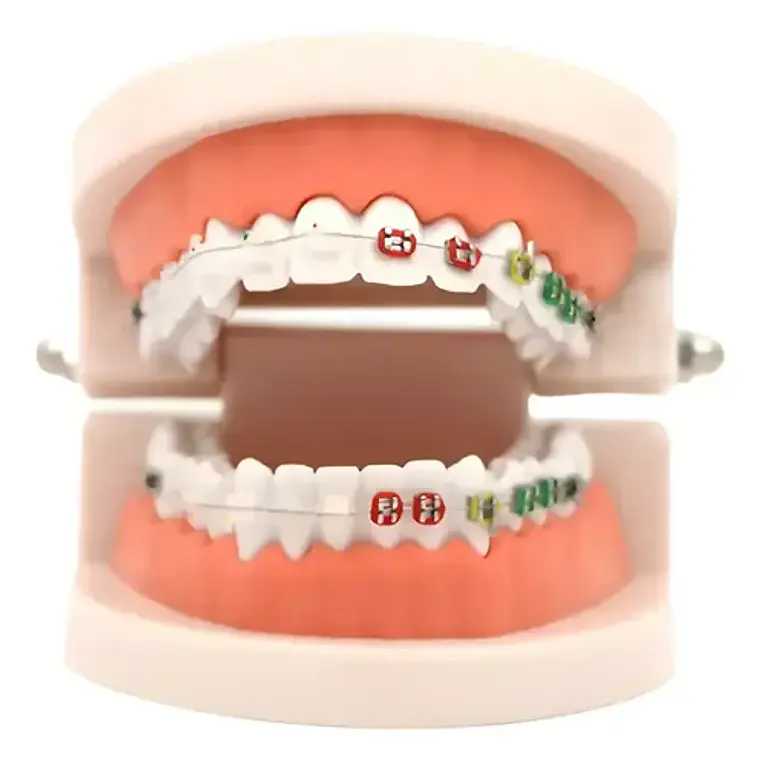 Modelo Dental Ortodoncia Enseñanza Y Estudio Santiago 1