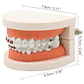 Modelo Dental Ortodoncia Enseñanza Y Estudio Santiago - Miniatura 3