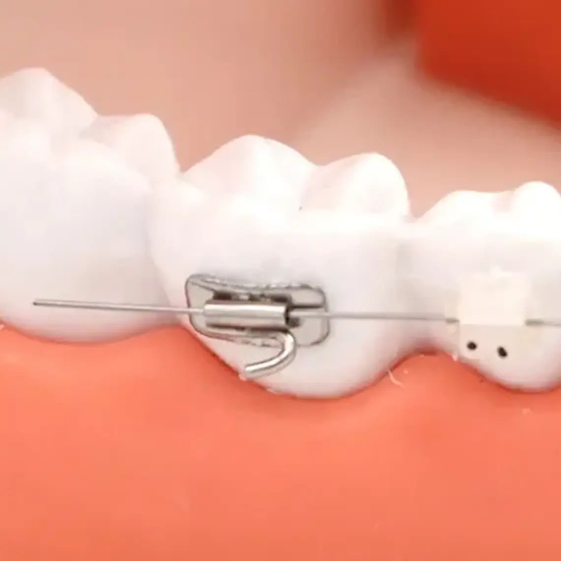 Modelo Dental Ortodoncia Enseñanza Y Estudio Santiago 6