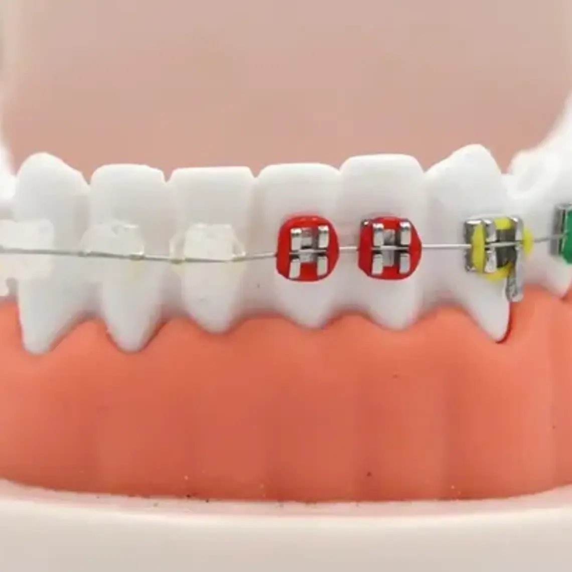 Modelo Dental Ortodoncia Enseñanza Y Estudio Santiago 7
