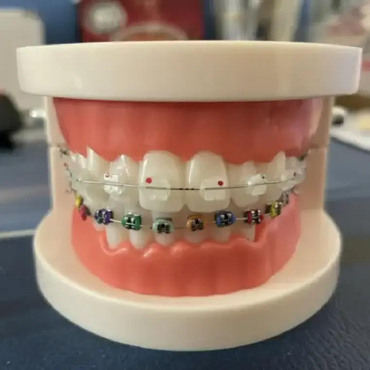 Modelo Dental Ortodoncia Enseñanza Y Estudio Santiago 10