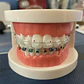 Modelo Dental Ortodoncia Enseñanza Y Estudio Santiago - Miniatura 10