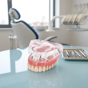 Modelo Sobre Dentadura Superior 4 Implantes Enseñanza