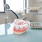 Modelo Sobre Dentadura Superior 4 Implantes Enseñanza - Miniatura 1