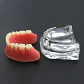 Modelo Sobre Dentadura Superior 4 Implantes Enseñanza - Miniatura 4