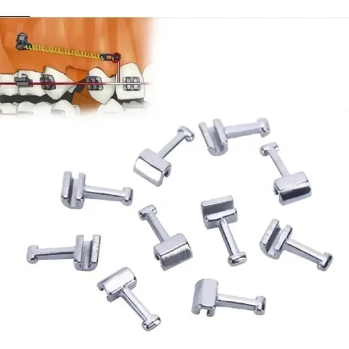 Crimpables Hook Ortodoncia Bolsita 10u Santiago 22