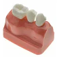Modelo Dental Enseñanza Y Estudio Puente Gigante Santiago - Miniatura 5