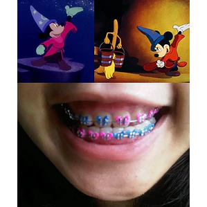 Ligaduras Ortodoncia De Mickey Mouse Colores 1000u Santiago