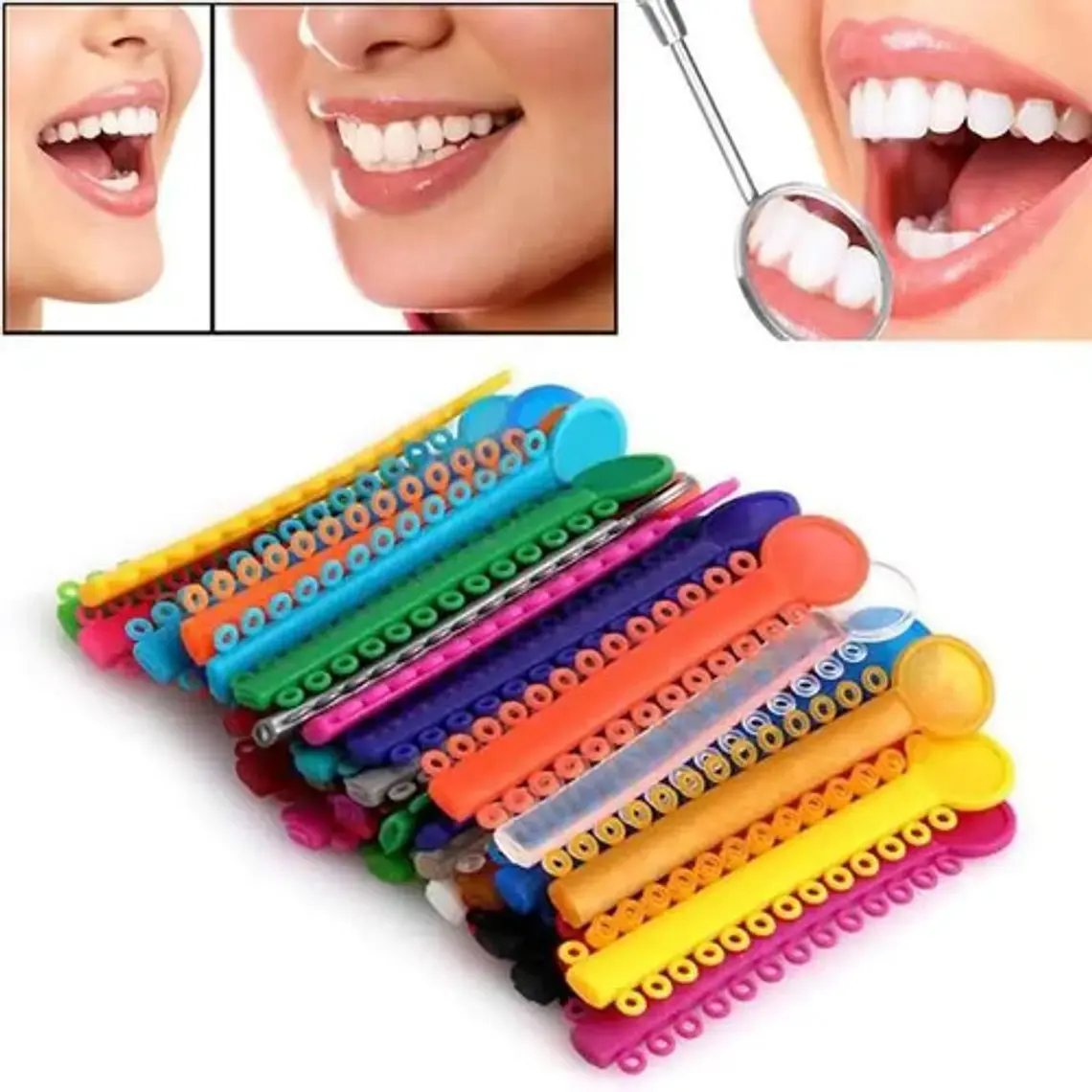 Ligaduras Ortodoncia Elásticos Multicolores Las Más Lindas 2