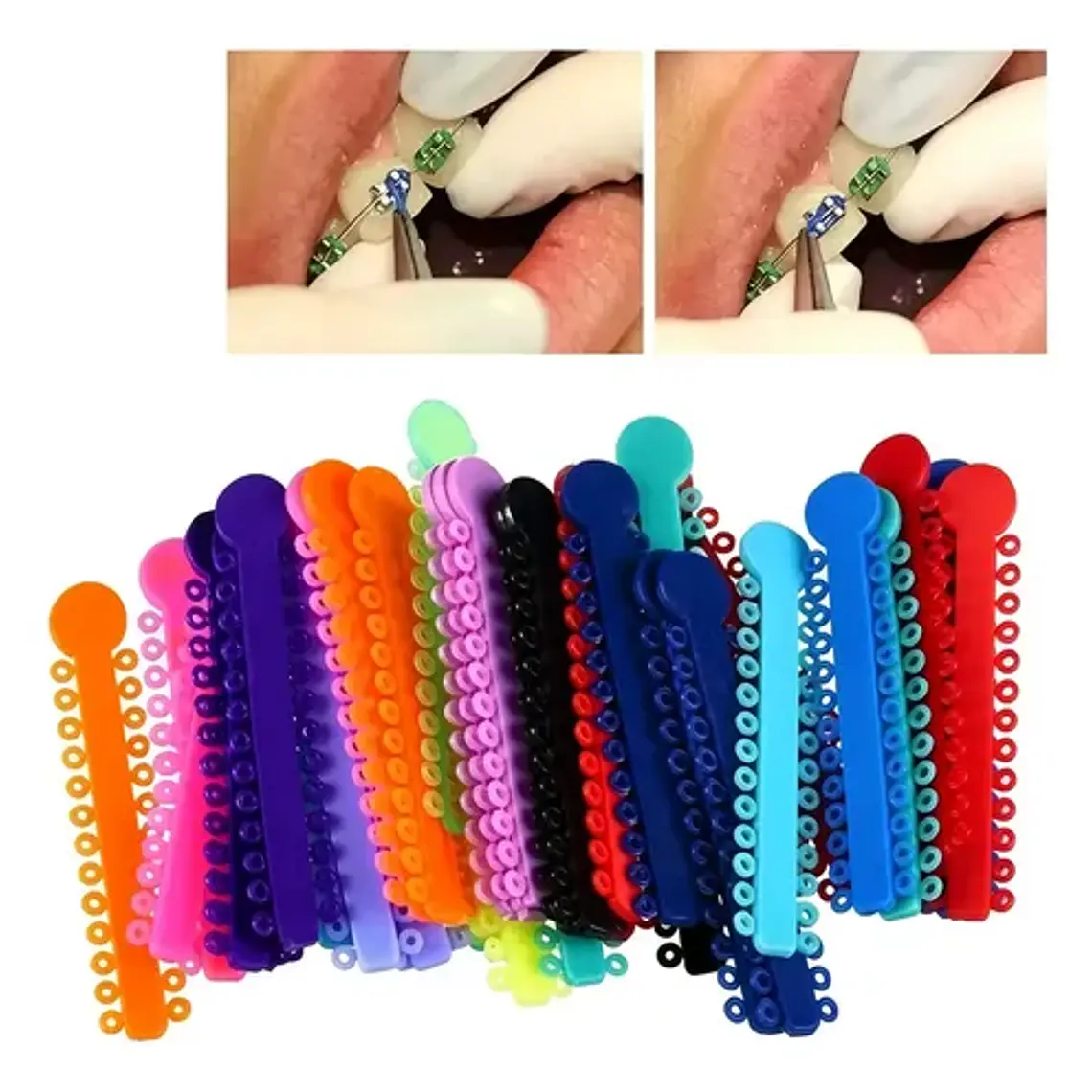 Ligaduras Ortodoncia Elásticos Multicolores Las Más Lindas 4