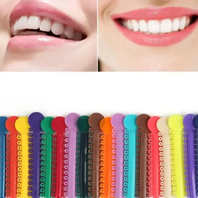 Ligaduras Ortodoncia Elásticos Multicolores Las Más Lindas 7