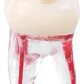 Molar Para Práctica Endodoncia Enseñanza Santiago - Miniatura 2