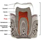 Modelo Endodoncia Dental Acrílico Enseñanza Didáctico Stgo. - Miniatura 9