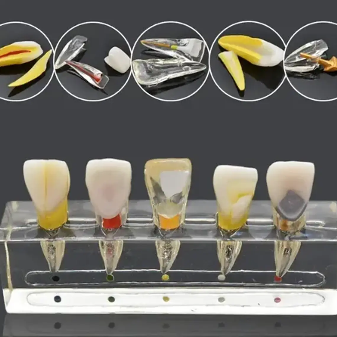 Modelo Endodoncia Dental Acrílico Enseñanza Didáctico Stgo. 10