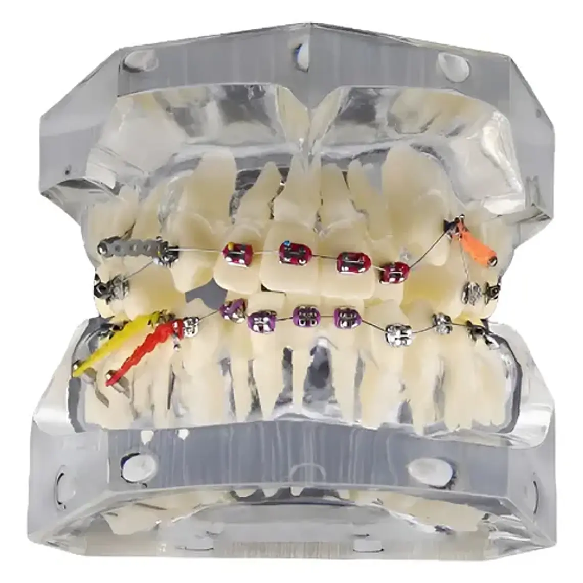Modelo Dental Ortodoncia Brackets Acrilico Con Adm Santiago 1