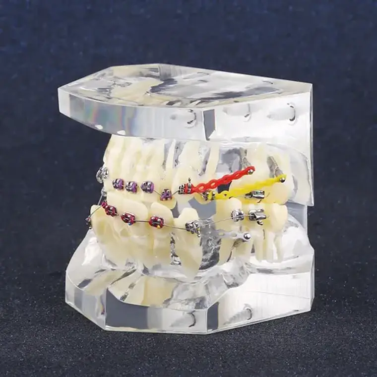 Modelo Dental Ortodoncia Brackets Acrilico Con Adm Santiago 5