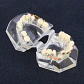 Modelo Dental Ortodoncia Brackets Acrilico Con Adm Santiago - Miniatura 7
