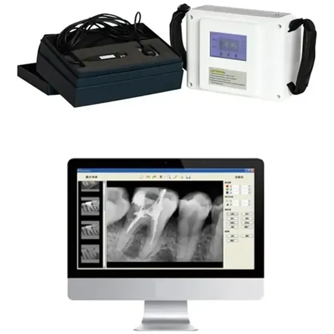 Maquina De Rayos X Lcd Touch Portatil Con Maletín Calidad 4