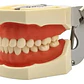 Modelo Arcada Dental Tipo Nissin Encia Blanda 28 Piezas Stgo - Miniatura 1