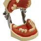 Modelo Arcada Dental Tipo Nissin Encia Blanda 28 Piezas Stgo - Miniatura 3