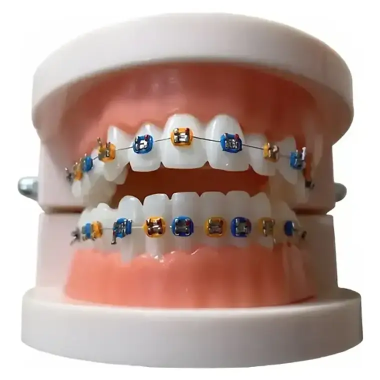 Modelo Dental Ortodoncia Enseñanza Brackets Metálicos Stgo. 1