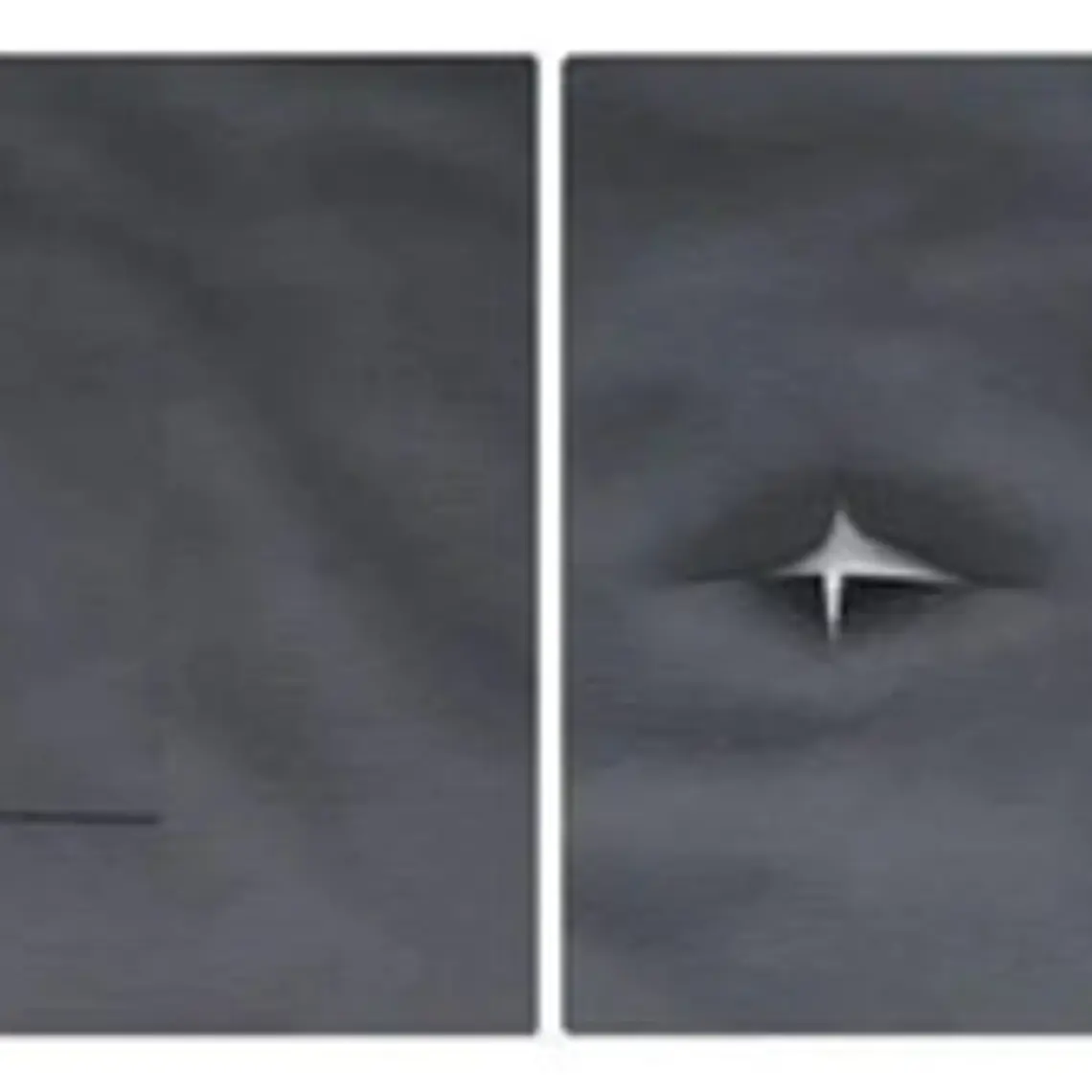 Parche Cuerina Xl Reparación Autoadhesivo Tapiz 50x137 Cms 9