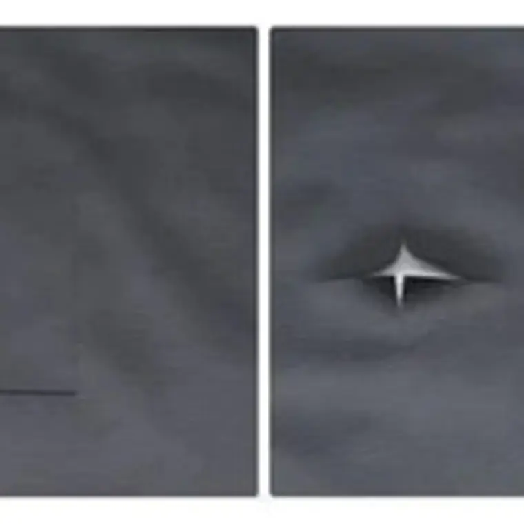 Parche Cuerina Xl Reparación Autoadhesivo Tapiz 50x137 Cms 9