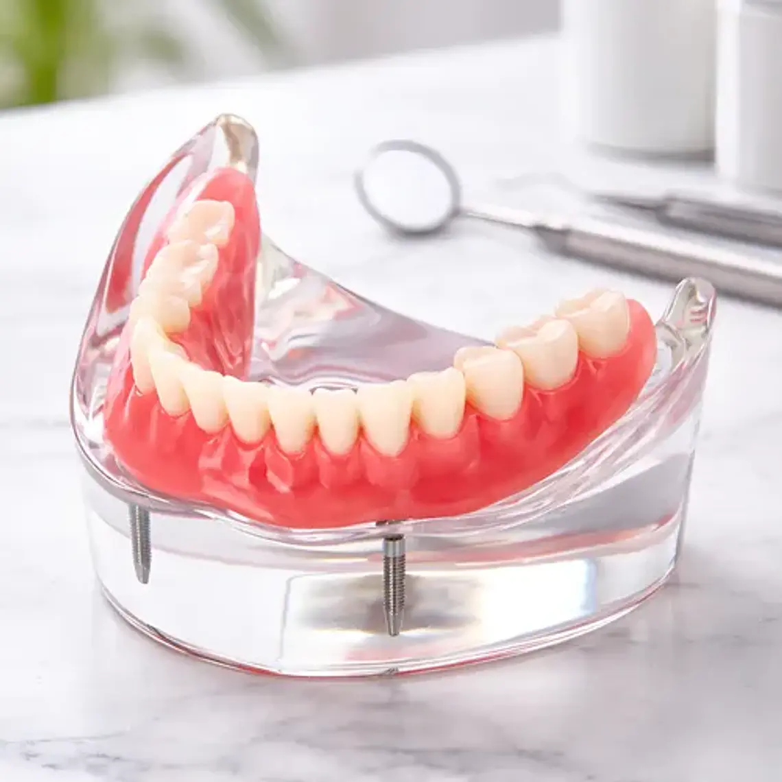 Modelo Sobre Dentadura Inferior 2 Implantes Enseñanza 1