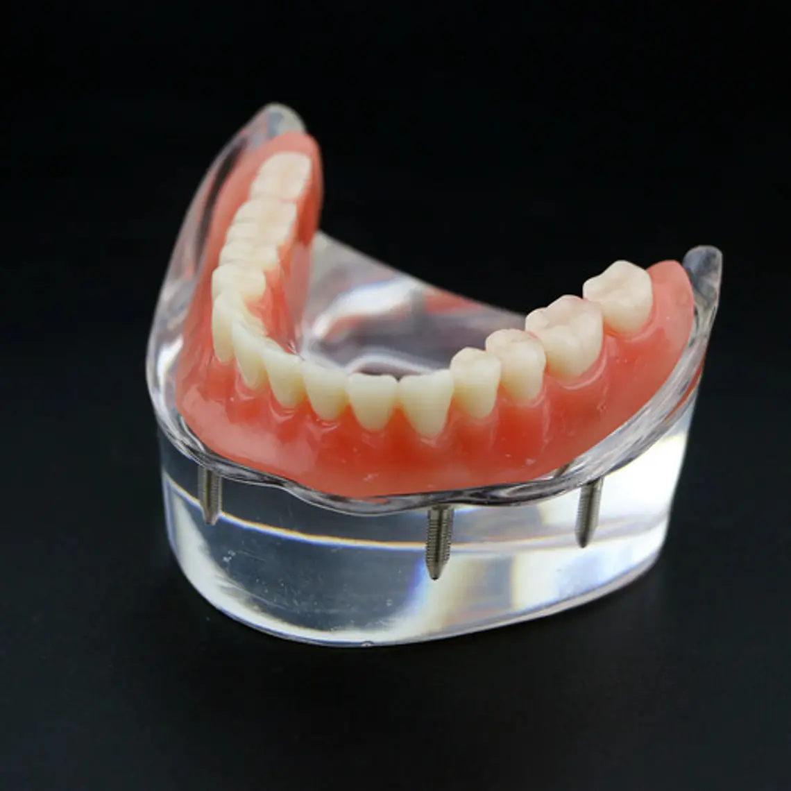 Modelo Sobre Dentadura Inferior 2 Implantes Enseñanza 5