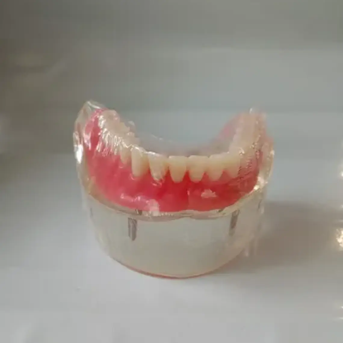 Modelo Sobre Dentadura Inferior 2 Implantes Enseñanza 9