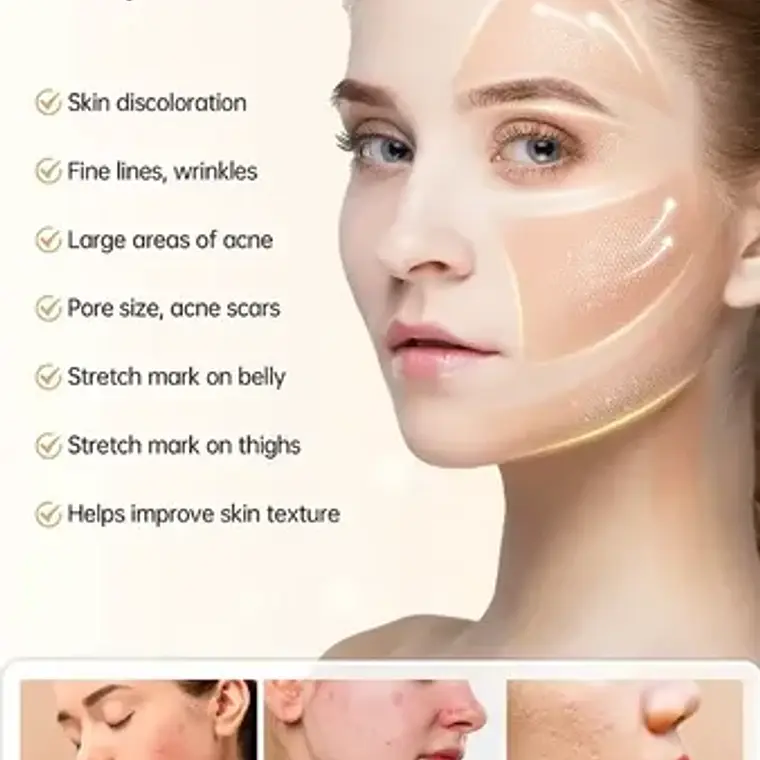 Dermapen Hydrapen H5 Inalambrico + 12 Cartuchos De Regalo 5