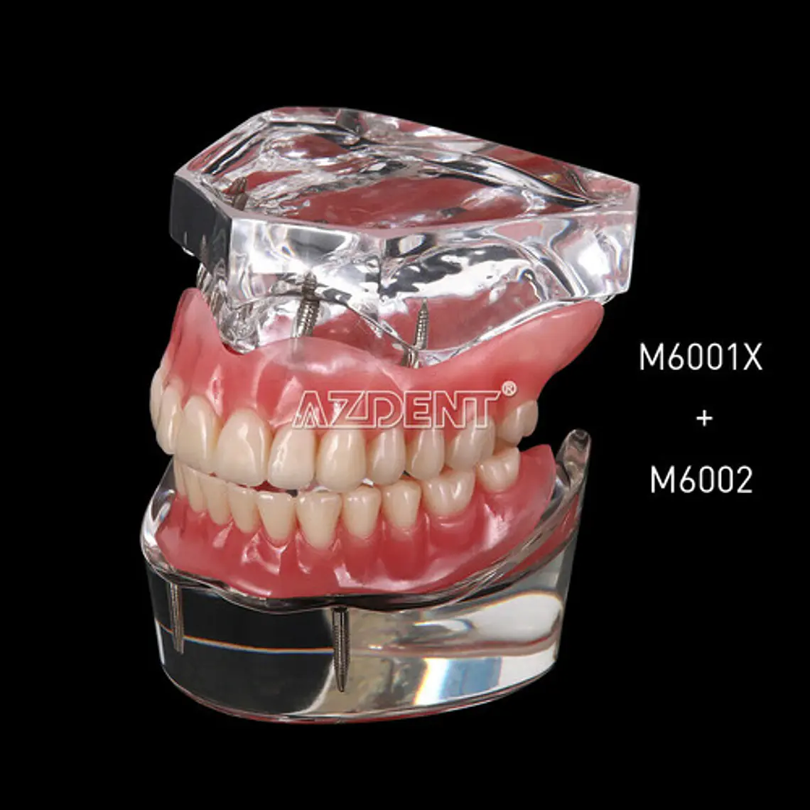 2 Modelos Sobre Dentadura Implantes Enseñanza Santiago 2