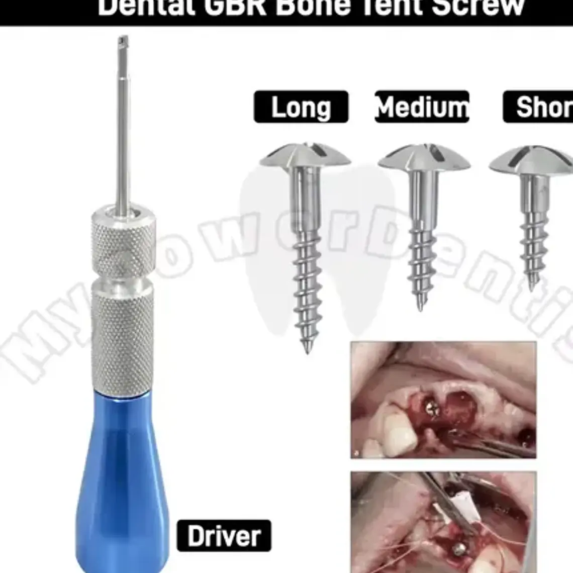 Set Destornillador Microtornillos X5 Ortodoncia Implante Den 4