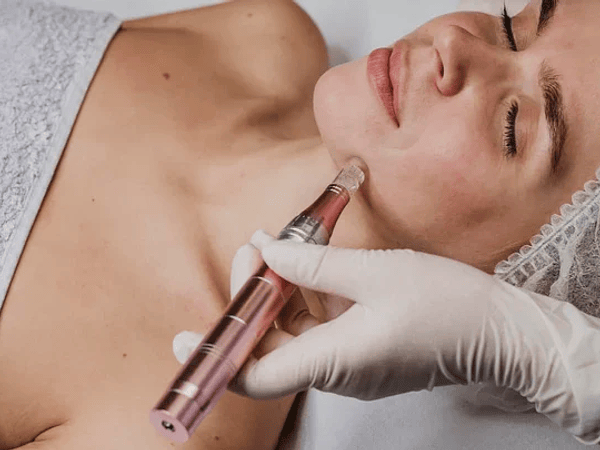 Mesoterapia Estética y sus Aplicaciones